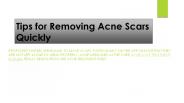 Tips for Removing Acne Scars Quickly