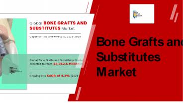 Bone Grafts and Substitutes Market Size PPT