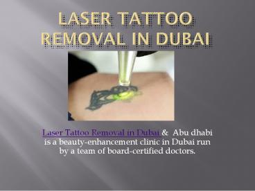 What is Laser Tattoo Removal?