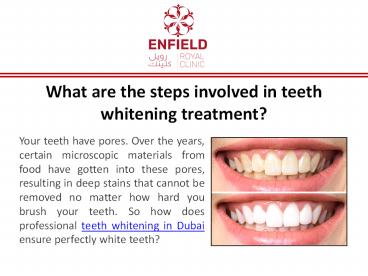 What are the steps involved in teeth whitening treatment?
