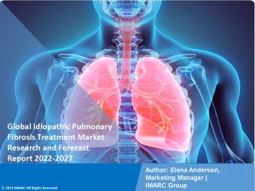 Idiopathic Pulmonary Fibrosis Treatment Market PPT: Growth, Outlook, Demand, Keyplayer Analysis and Opportunity 2022-27