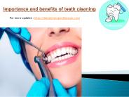 Importance and Benefits of Teeth Cleaning