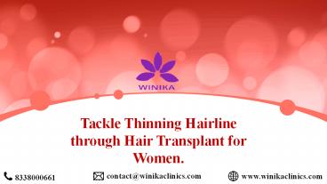 Tackle Thinning Hairline through Hair Transplant for Women.
