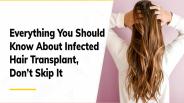A Brief Guide About Infected Hair Transplant