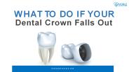 What to Do if Your Crown Falls Off