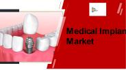 Medical Implant Market Statistics - 2027
