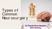 Brain tumor surgery hospital Coimbatore
