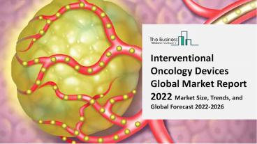 2022 Interventional Oncology Devices Market Industry Outlook, Growth And Trends