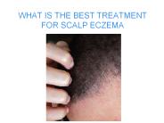 WHAT IS THE BEST TREATMENT FOR SCALP ECZEMA