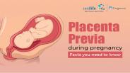 Placenta Previa During Pregnancy: Facts You Need To Know