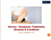 Verruca - Symptoms, Treatments, Illnesses & Conditions