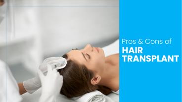 Pros & Cons of Hair Transplant
