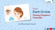 Treat Dark Circles During Pregnancy Naturally: An Essential Guide