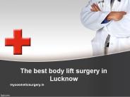 Body lift surgery in Lucknow