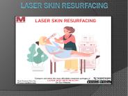 Laser Skin Resurfacing