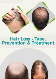 Hair Loss Treatment