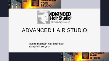 Tips for post-surgery of hair transplant in Dubai