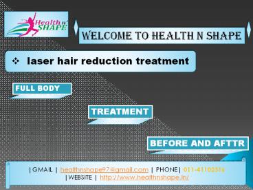 Laser Hair reduction in Preet Vihar, Delhi
