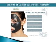 Benefits of Carbon Laser Peel Treatment