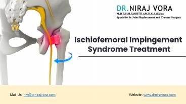 Ischiofemoral Impingement Syndrome Treatment | Dr Niraj Vora
