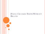 Fixing Crooked Teeth Without Braces