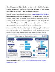 Organs-on-Chips Market Size, Research, Analysis