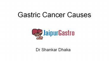 Gastric Cancer Causes
