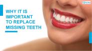 Why It Is Important to Replace Missing Teeth