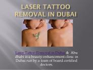 Laser tattoo removal in dubai