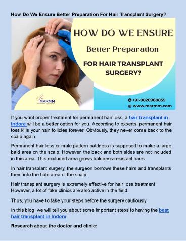 How Do We Ensure Better Preparation For Hair Transplant Surgery?