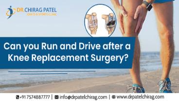 How Long Before You Can Run After Knee Replacement Surgery