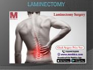 Laminectomy Surgery
