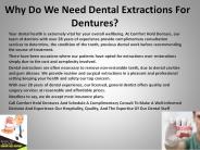 Why Do We Need Dental Extractions For Dentures?
