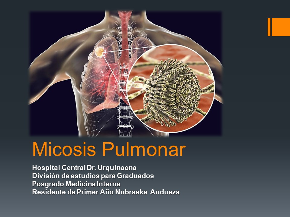 Micosis Pulmonar