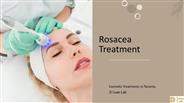 Rosacea | Book Free Consultation | D Luxe Lab