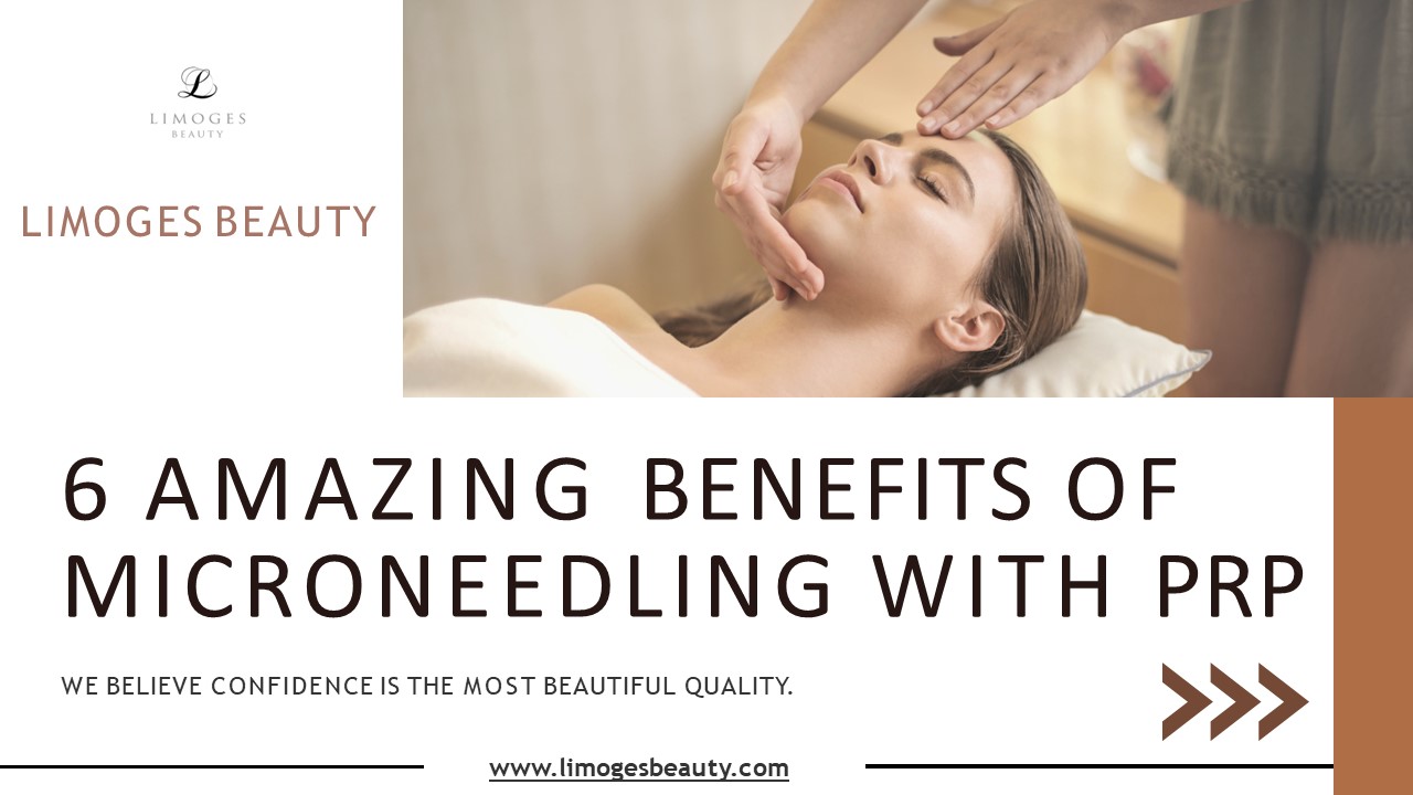 6 BENEFITS OF MICRONEEDLING With PRP