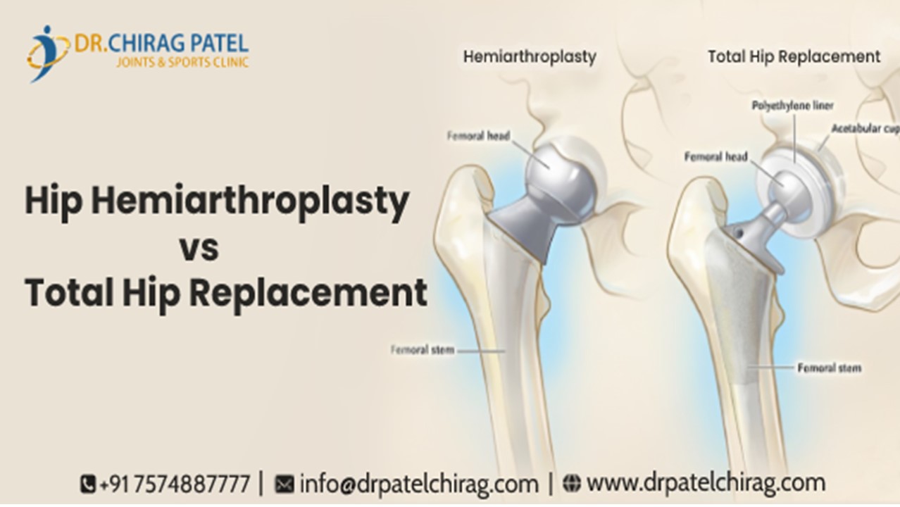 PPT Hip Hemiarthroplasty vs Total Hip Replacement Indications