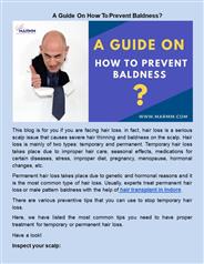 A Guide On How To Prevent Baldness?