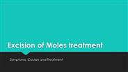 moles treatment