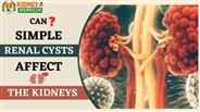 Can Simple Renal Cysts Affect The Kidneys?
