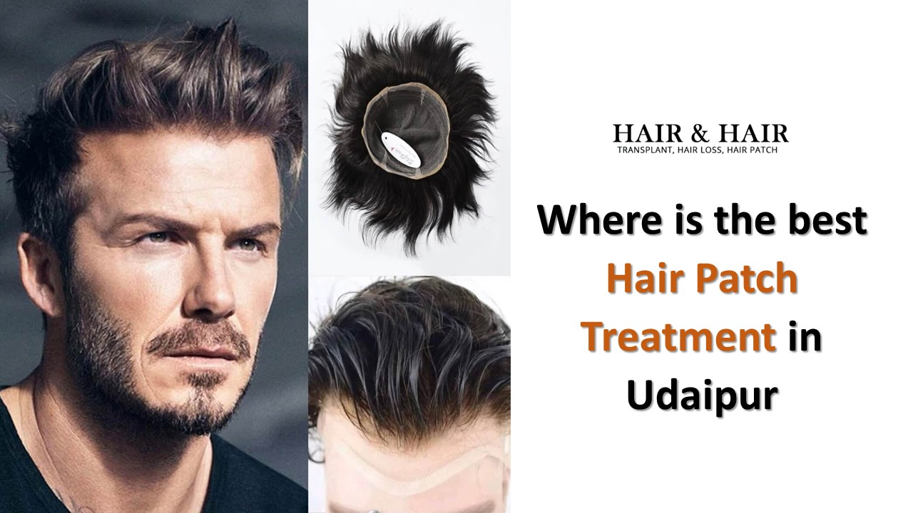 PPT Where is the best Hair Patch Treatment in Udaipur PowerPoint