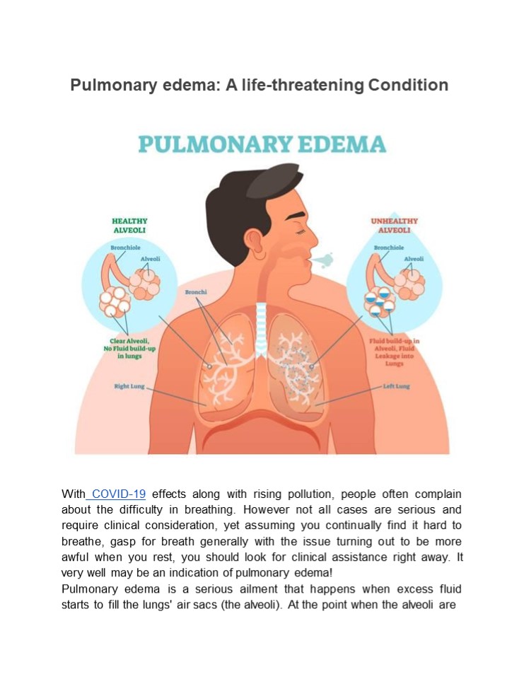 Pulmonary Edema - Causes, Symptoms and Treatment