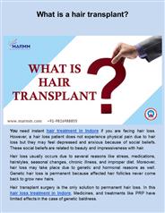 WHAT IS HAIR TRANSPLANT?