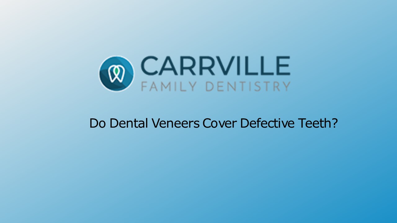 Do Dental Veneers Cover Defective Teeth?