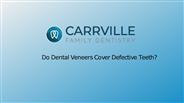 Do Dental Veneers Cover Defective Teeth?