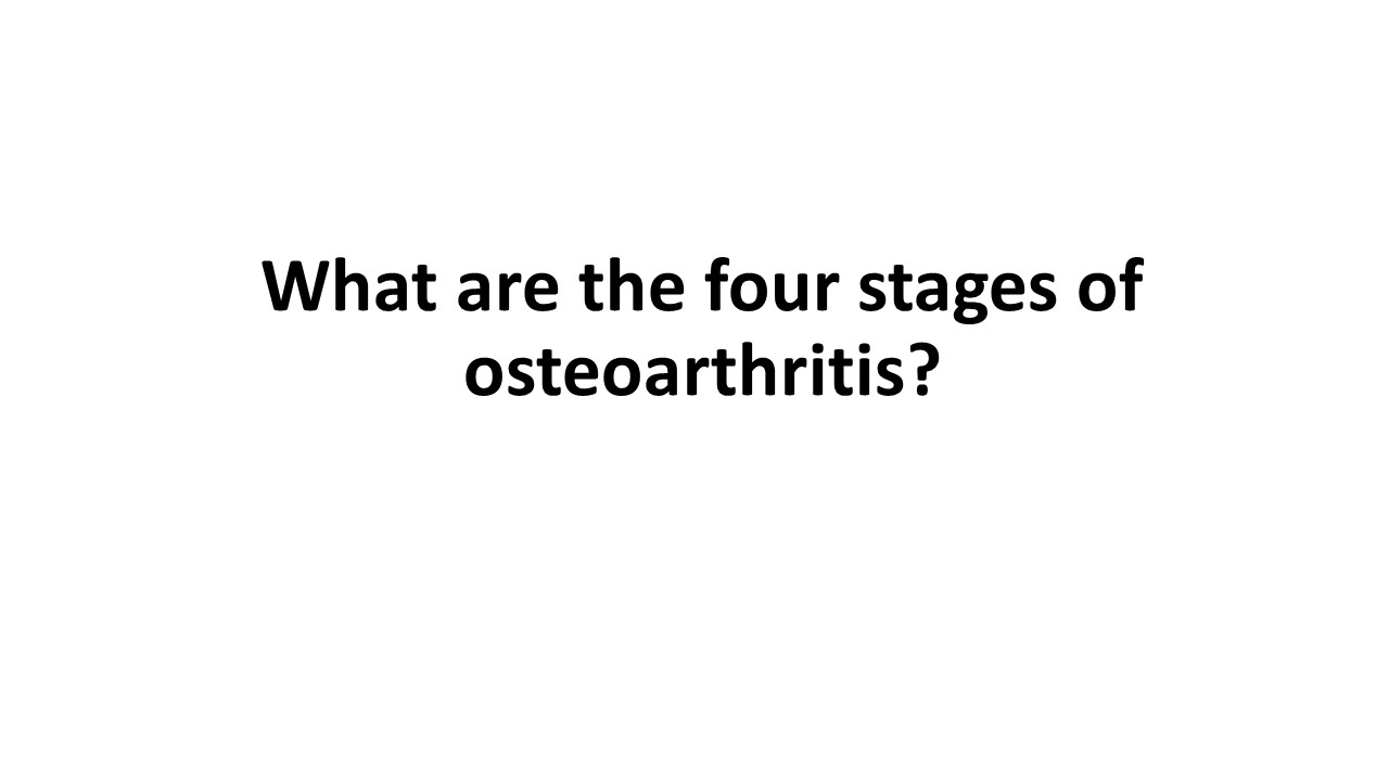 what are the four stages of osteoarthritis?