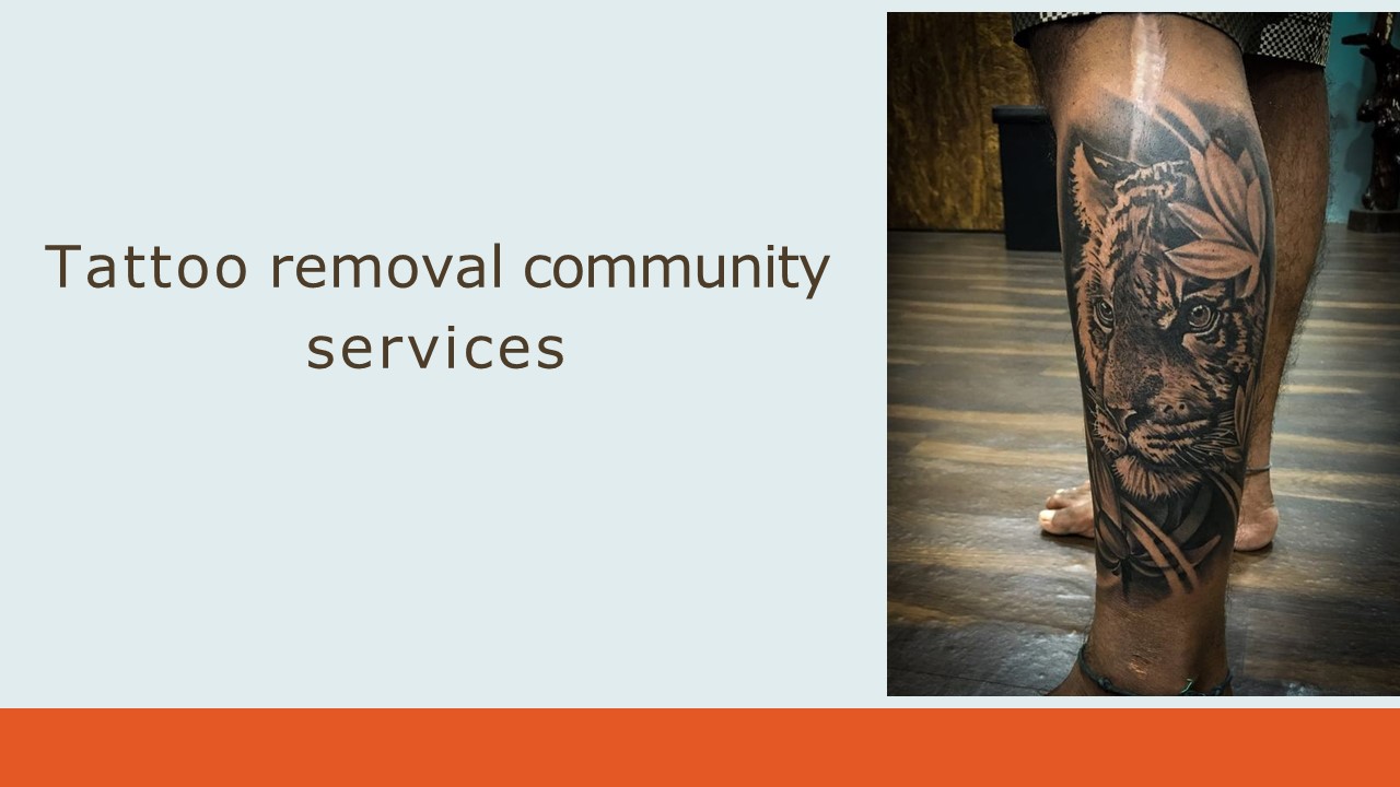Tattoo Removal Community Service