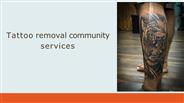 Tattoo Removal Community Service