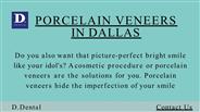 Porcelain Veneers in Dallas