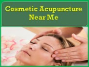 Cosmetic Acupuncture Near Me
